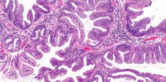 Wirusowe zapalenie typu B